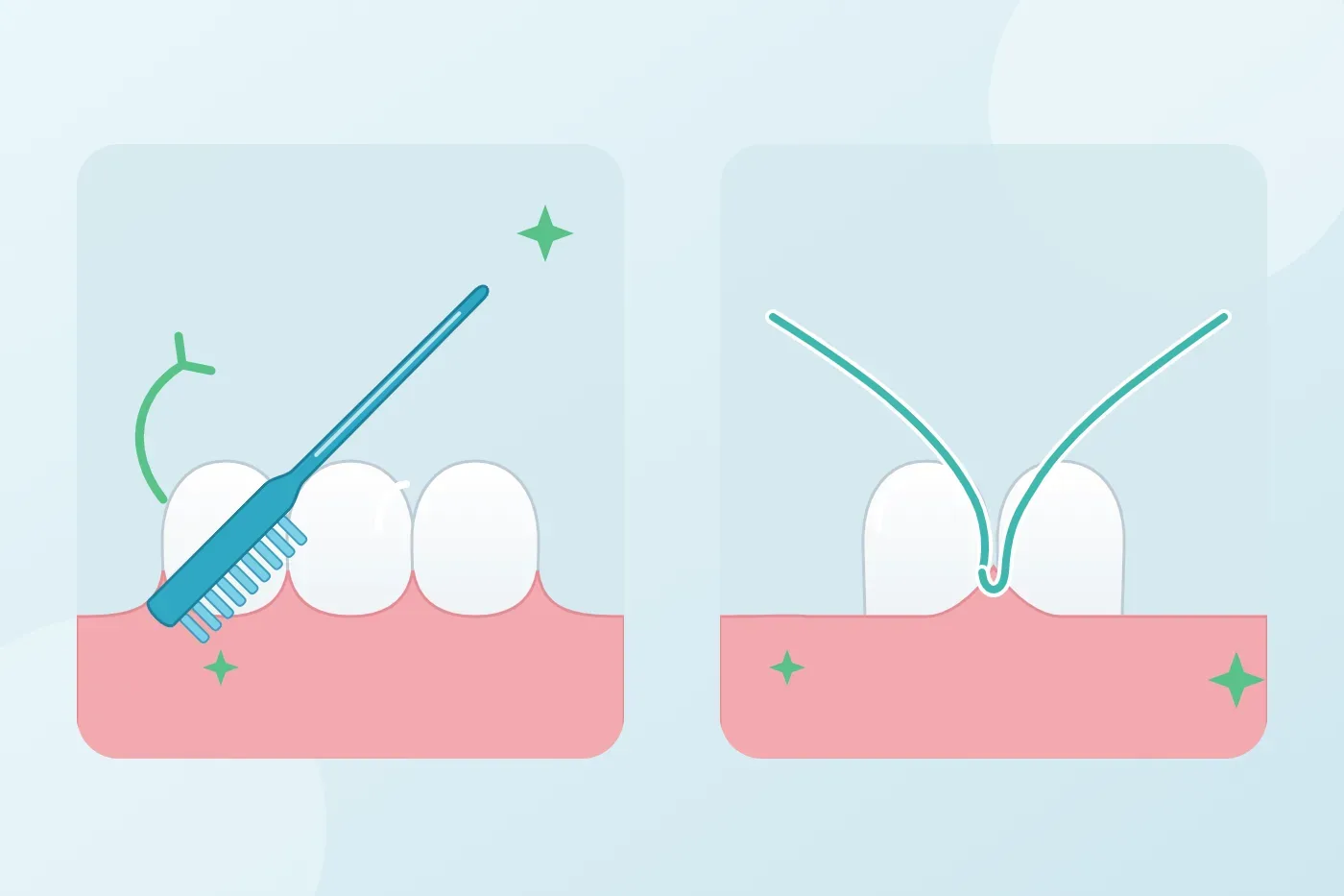 Minh họa bàn chải đánh răng nghiêng 45 độ chạm đường viền nướu và sợi chỉ nha khoa luồn vào kẽ răng