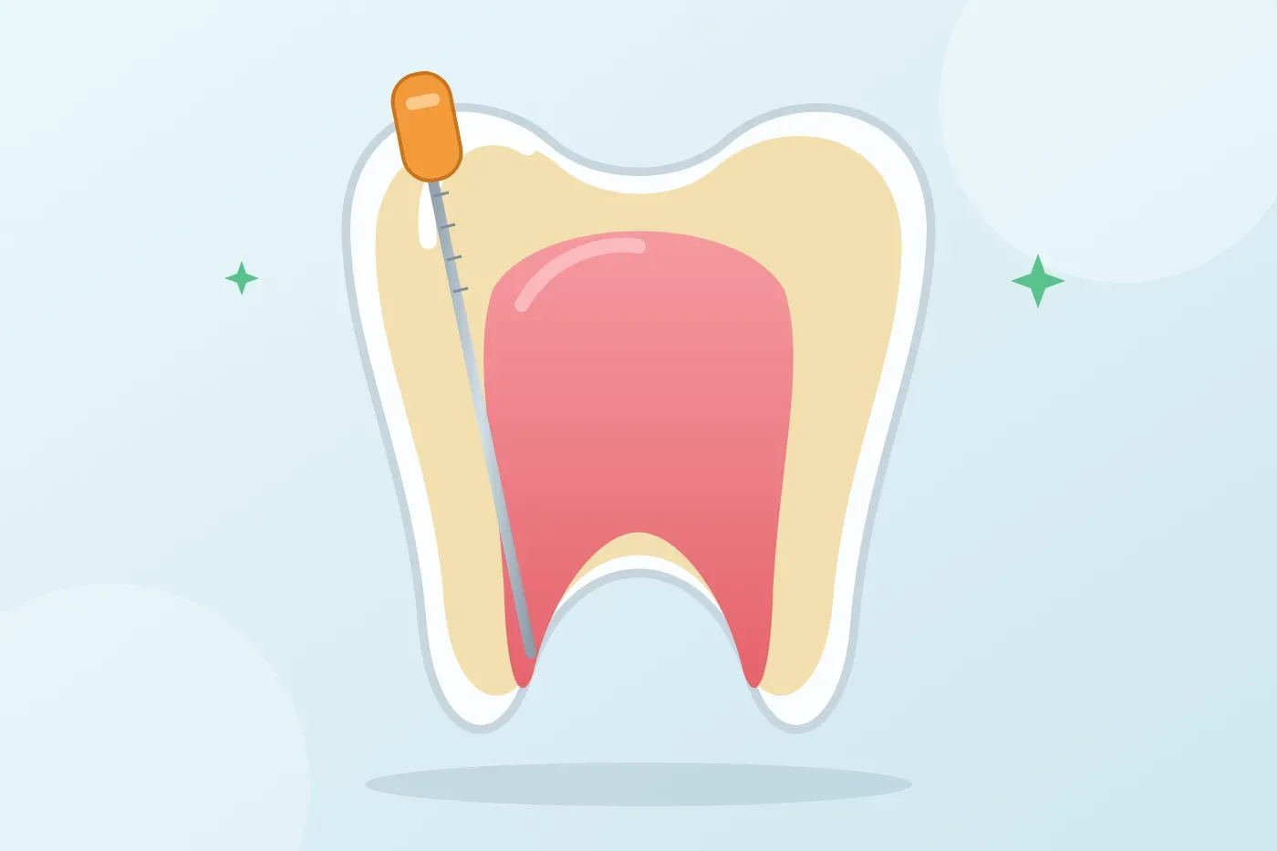 How many visits does root canal treatment take and how long does it last?