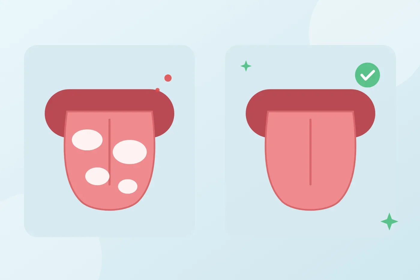 What causes a burning tongue or a white coated tongue, and when should you see a dentist?