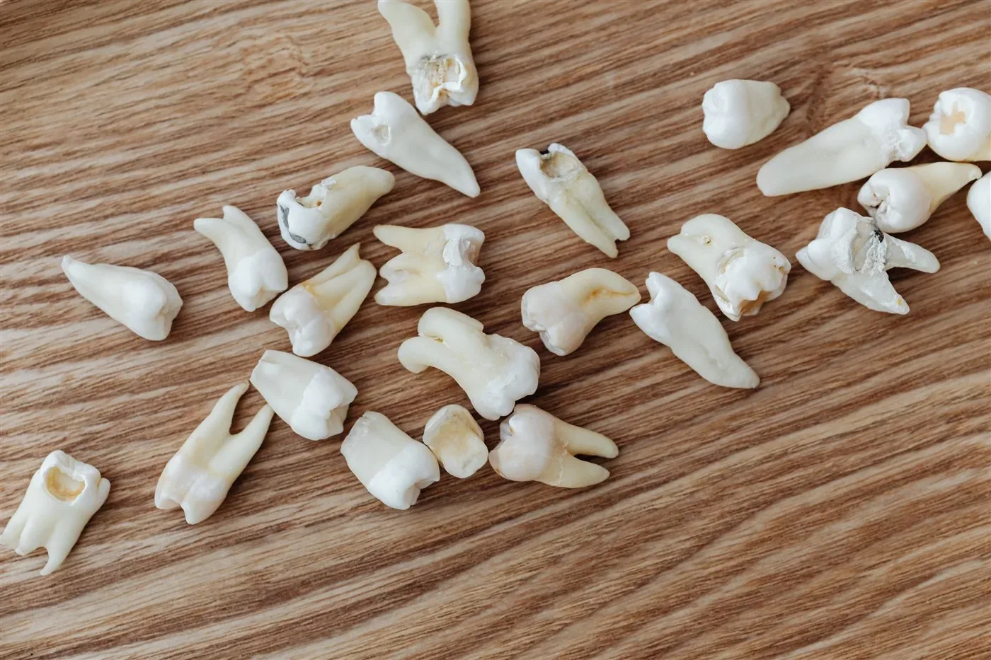 What is the difference between removing upper and lower wisdom teeth, and which is harder?