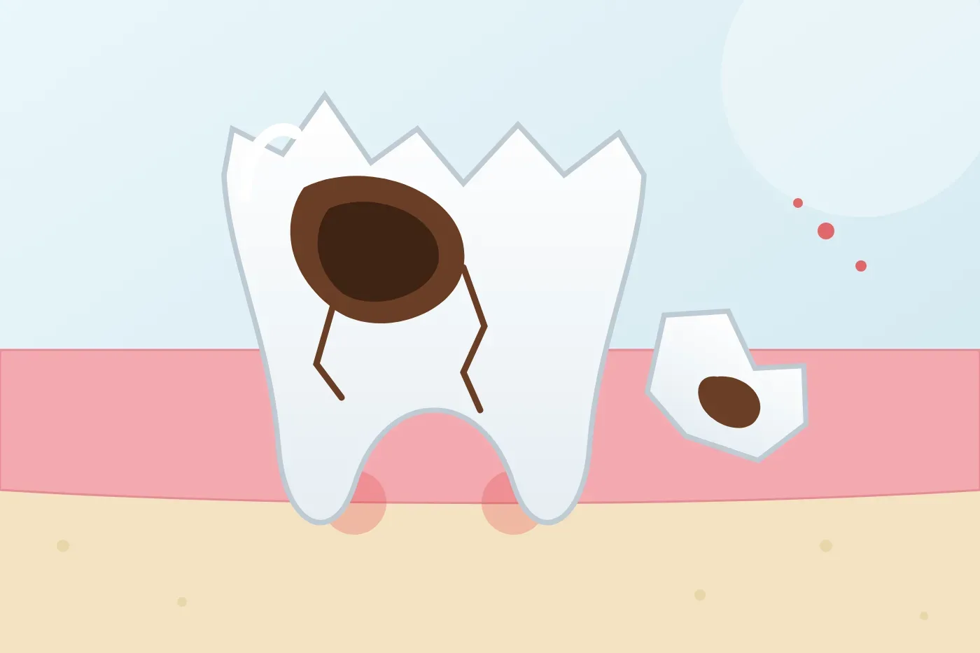 Should a decayed tooth broken down to the root be pulled and is it difficult?