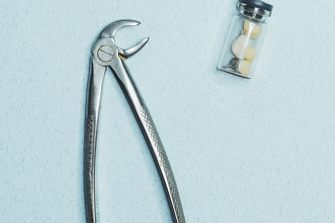 What is dry socket after tooth extraction, what are the signs and how can it be prevented?