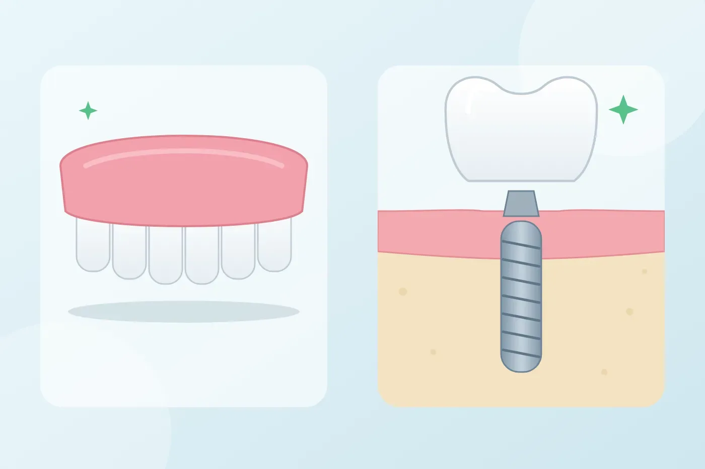 Removable dentures or dental implants, which should I choose?