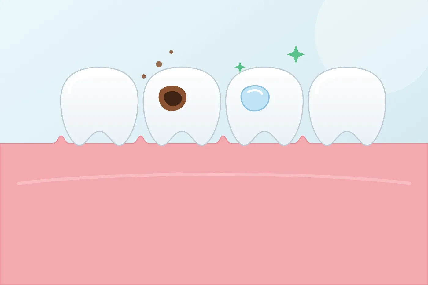 Do decayed baby teeth need fillings or can they be left until they fall out?