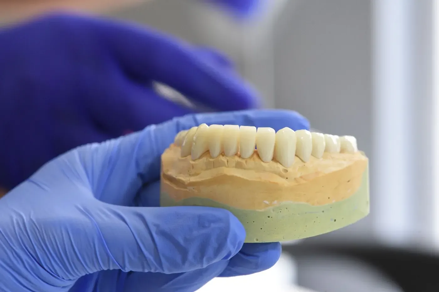 Which everyday habits are quietly harming your teeth?
