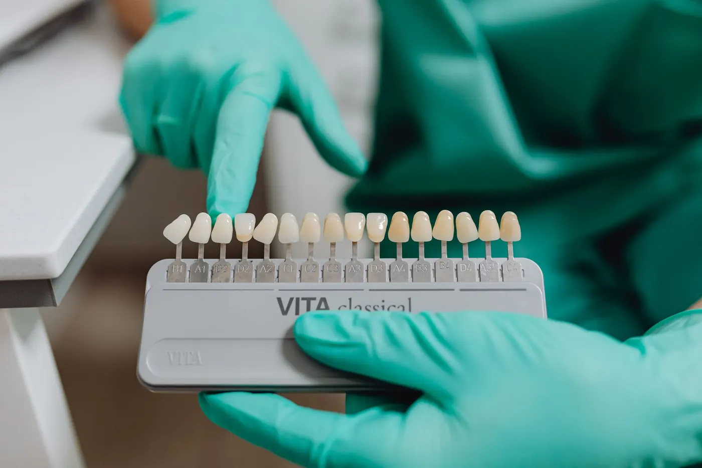 Dental Implants: Process, Timeline and What to Ask