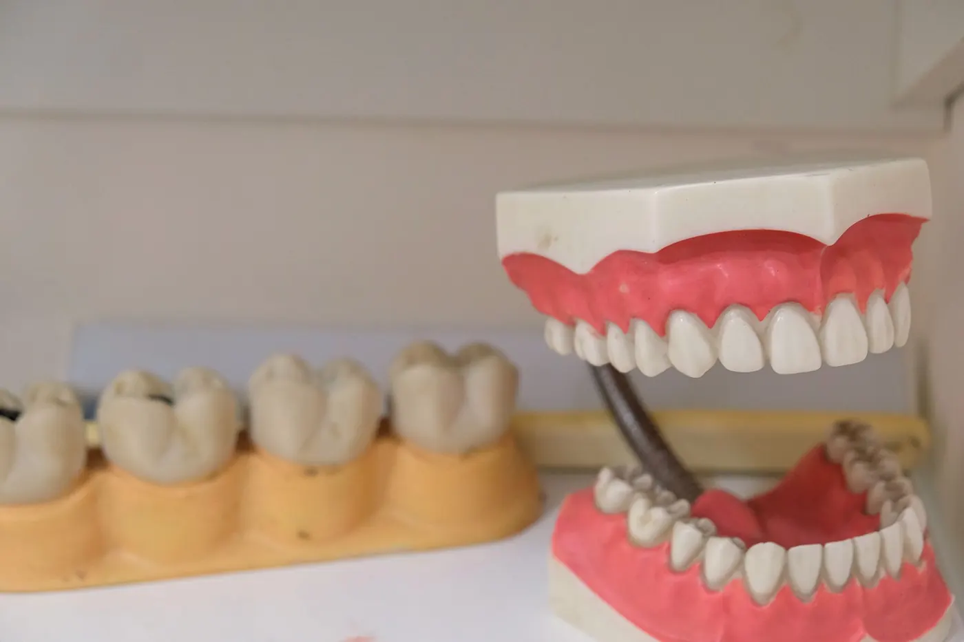 Which Dental Services Are Not Covered by Health Insurance?