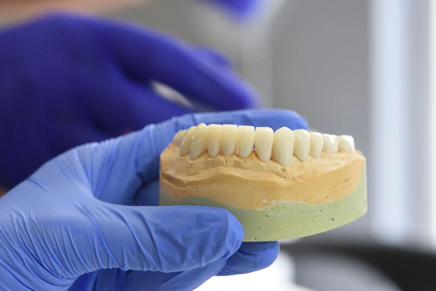 What is gum recession, why does it happen and can it be treated?